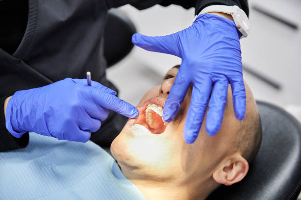 Best Knocked-Out Tooth (Avulsed Tooth) Treatment in Decatur, MS